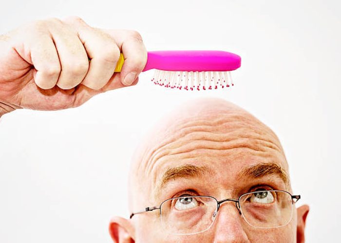 Jednostavni-i-prirodni-nacini-za-sprecavanje-opadanja-kose1